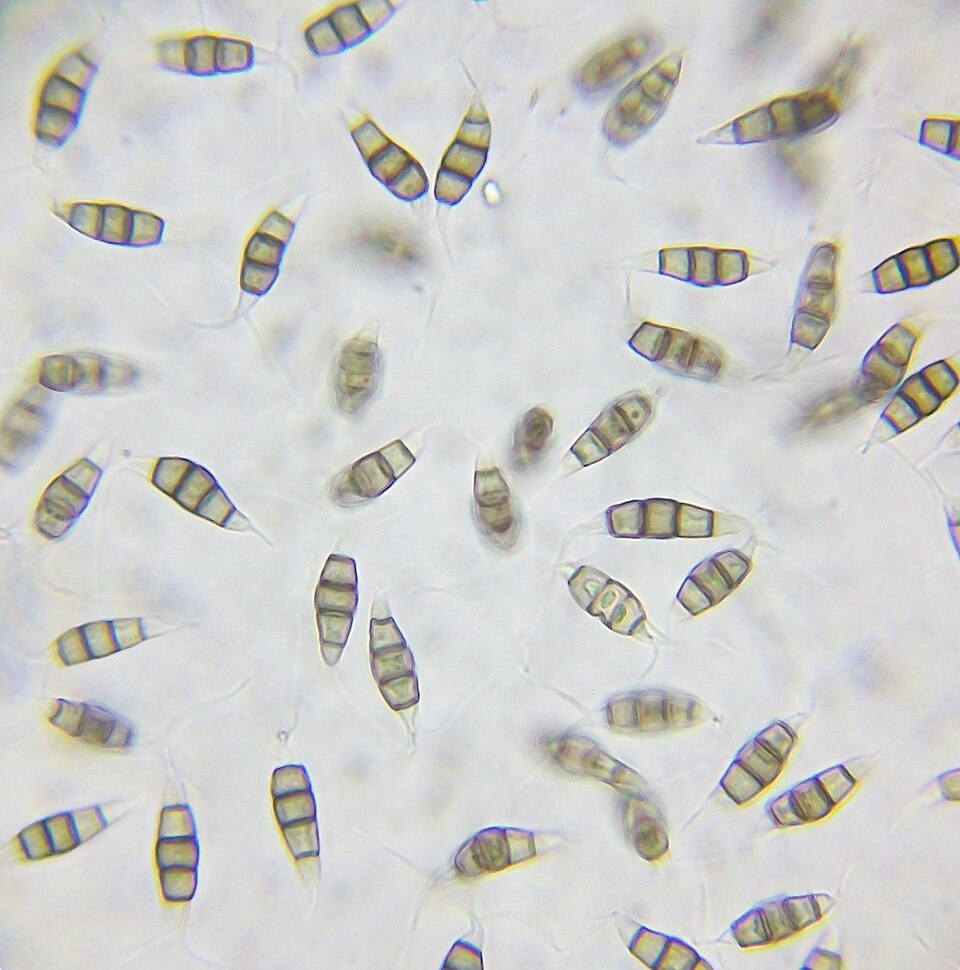 Pestalotiopsis microspora