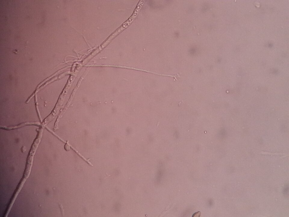Scedosporium apiospermum